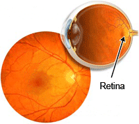 pigmented layer of retina